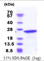 Human NCS1 / Neuronal Calcium Sensor Protein (Recombinant His)
