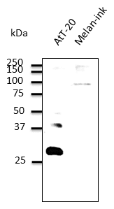 IHC-plus™ RAB27B Antibody (C-Terminus)