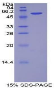 Mouse CDH3 / P-Cadherin Protein (Recombinant His-GST)