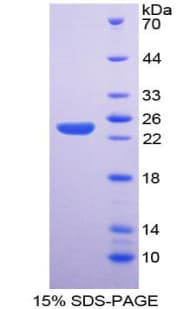 Dog NOS3 / eNOS Protein (Recombinant His-T7)