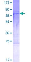 Human HYLS1 Protein (Recombinant GST)