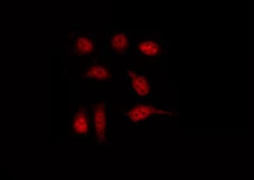 MAP2K1 / MKK1 / MEK1 Antibody