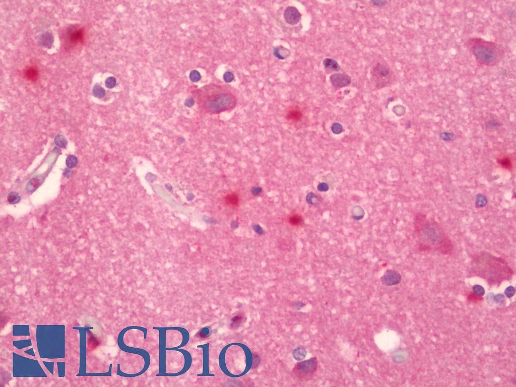 IHC-plus™ SERTAD1 / TRIP-Br1 / SEI-1 Antibody (aa168-217)