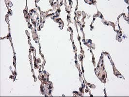 CAT / Catalase Antibody (clone OTI1B8)