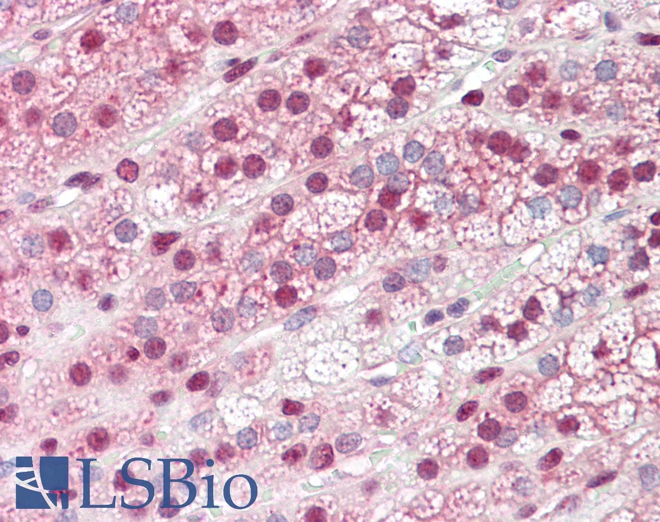 IHC-plus™ Polyclonal Rabbit anti-Human GBP6 Antibody (IHC, IF, WB)
