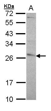 IHC-plus™ Polyclonal Rabbit anti-Human GSTP1 / GST Pi Antibody (N-Terminus, IHC, WB)