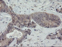 APP / Beta Amyloid Precursor Antibody (clone OTI4C9)