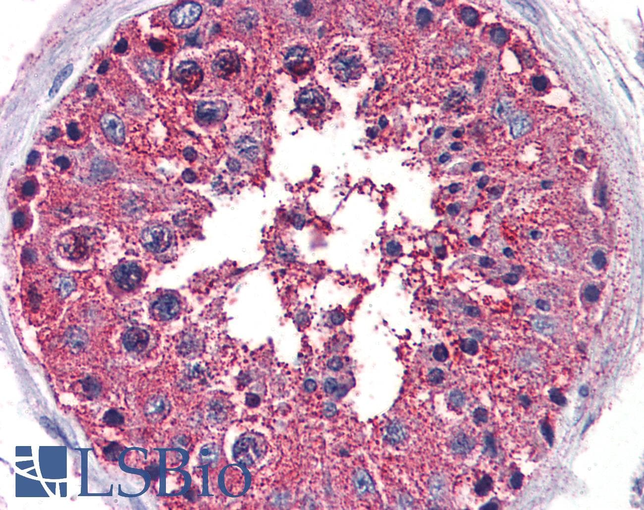 PathPlus™ PKD3 / PRKD3 Antibody (Internal)
