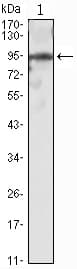 Monoclonal Mouse anti-Human SNAI2 / SLUG Antibody (clone 2H5, WB)