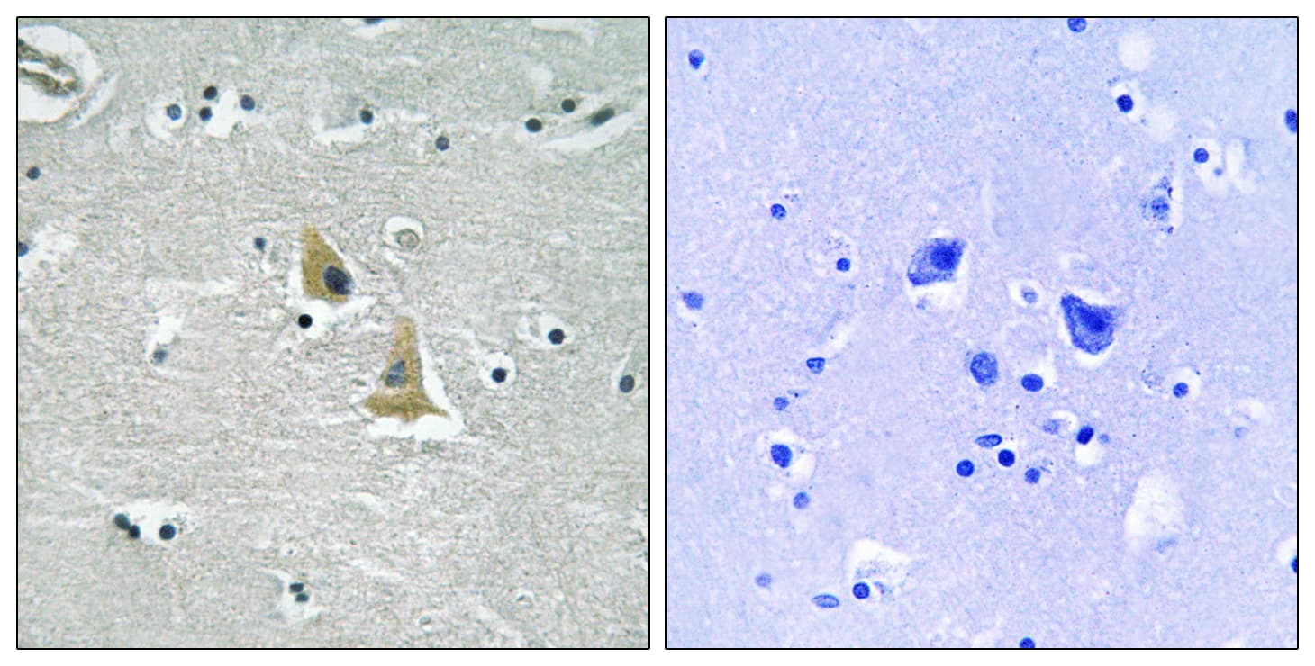 NCF1 / p47phox / p47 phox Antibody (aa311-360)