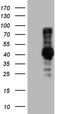 Monoclonal Mouse anti-Human NR3C1/Glucocorticoid Receptor Antibody (clone OTI1B11, aa1-265, WB)