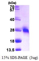 Human GGCT Protein (Recombinant His)