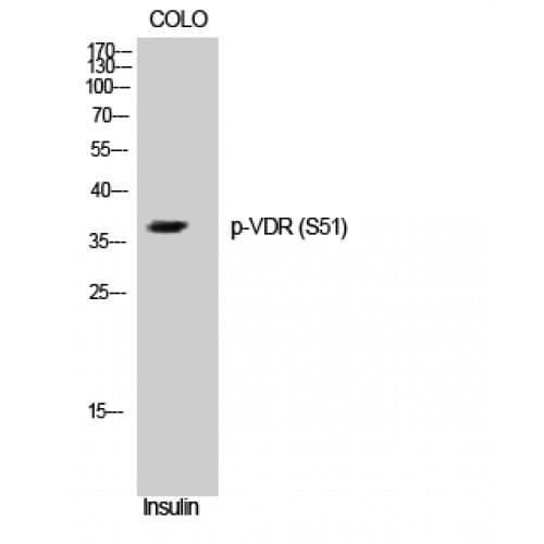 Vitamin D Receptor / VDR Antibody (30-110 aa)