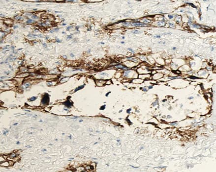 ANGPTL4 Antibody