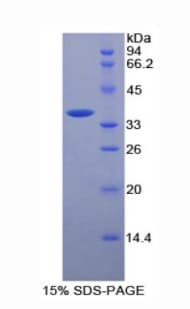 Mouse MCAM / CD146 Protein (Recombinant His)