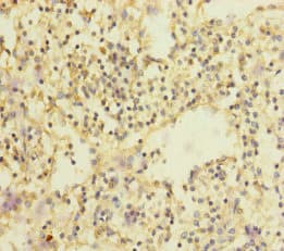 Polyclonal Rabbit anti-Human SLC35A1 Antibody (IHC)