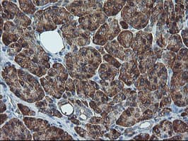 SH2D2A Antibody (clone OTI4F3)