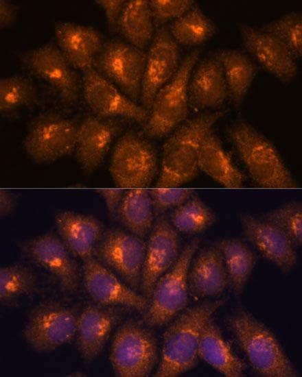 B3GNT4 Antibody