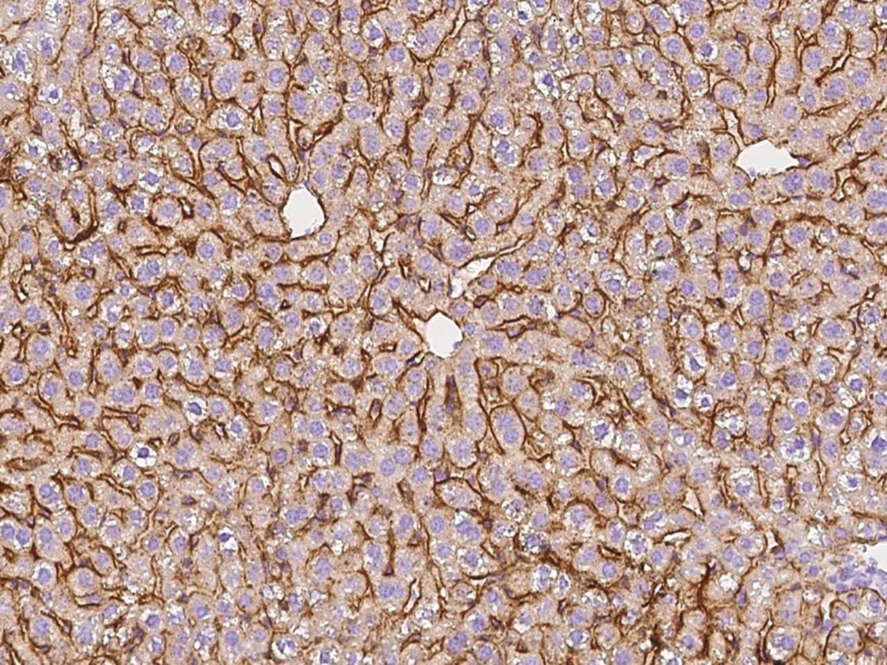 ASGR1 / ASGPR Antibody (Preservative Free)