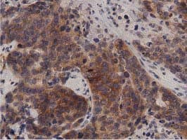 PRKD2 / PKD2 Antibody (clone OTI5G1)