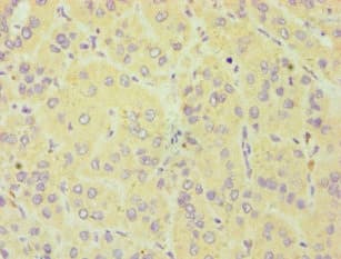 CYGB / Cytoglobin Antibody (aa1-190)