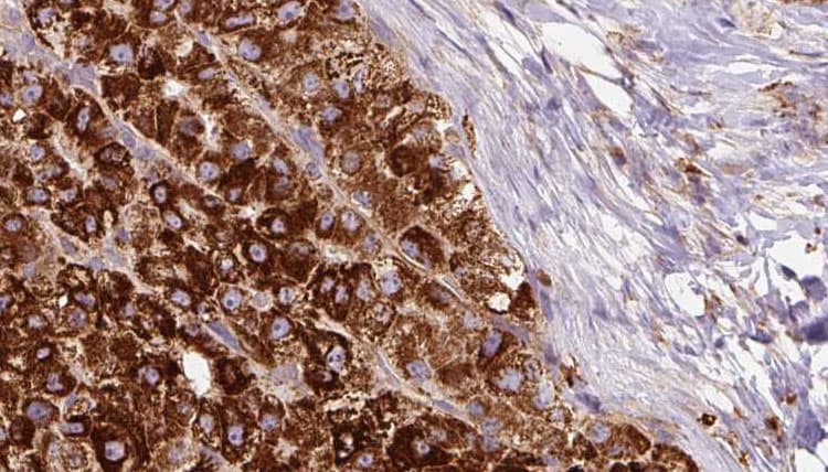 Polyclonal Rabbit anti-Human PTGER1 / EP1 Antibody (IHC, IF, WB)