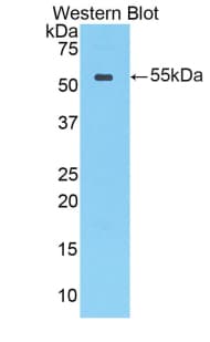 CTSA / Cathepsin A Antibody (aa151-394, Cy3)