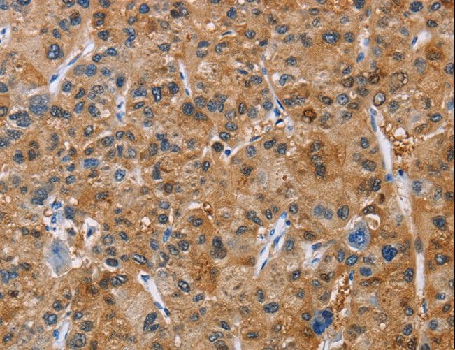 Polyclonal Rabbit anti-Human NKP30 Antibody (IHC)