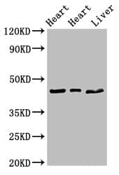 Polyclonal Rabbit anti-Human ECI2 / PECI Antibody (IHC, WB)