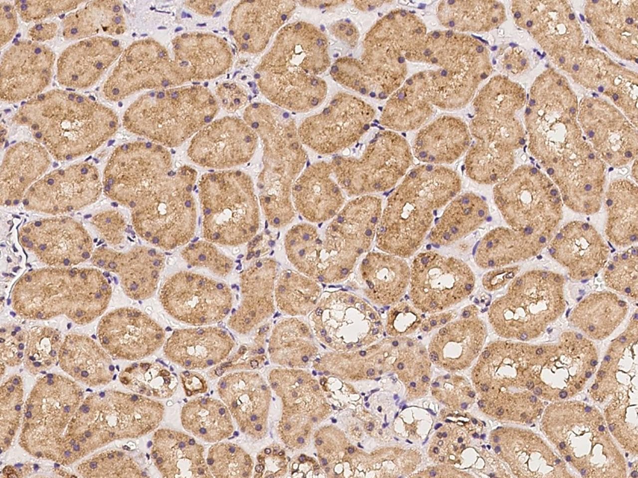 Polyclonal Rabbit anti-Human PODNL1 Antibody (IHC)