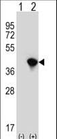 AIMP2 Antibody (aa156-184)