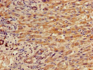 ITGB5 / Integrin Beta 5 Antibody