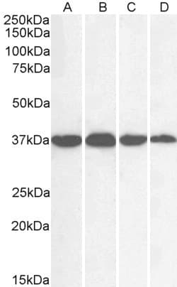 IHC-plus™ Polyclonal Goat anti-Human GAPDH Antibody (aa279-290, IHC, IF, WB)