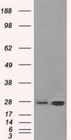 HSD17B10 / HADH2 Antibody (clone OTI10B4)