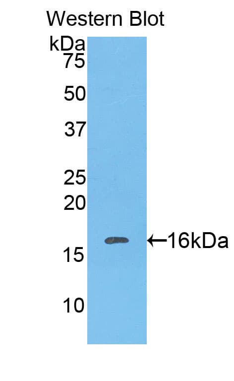 CAT / Catalase Antibody (aa10-507)