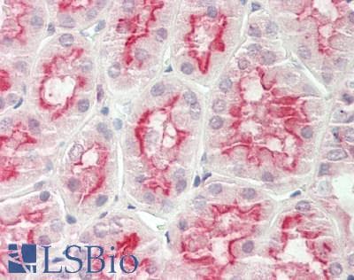 ARSE / Arylsulfatase E Antibody (aa504-553)