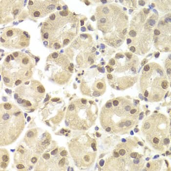 Polyclonal Rabbit anti-Human POU2F1 / OCT1 Antibody (IHC, WB)