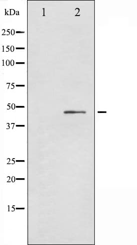 TP53 / p53 Antibody (phospho-Ser366)