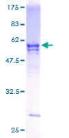 Human UBE2R2 Protein (Recombinant GST)