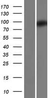 ZC3H12B Protein (Over-Expression Lysate Myc-DDK (Flag))
