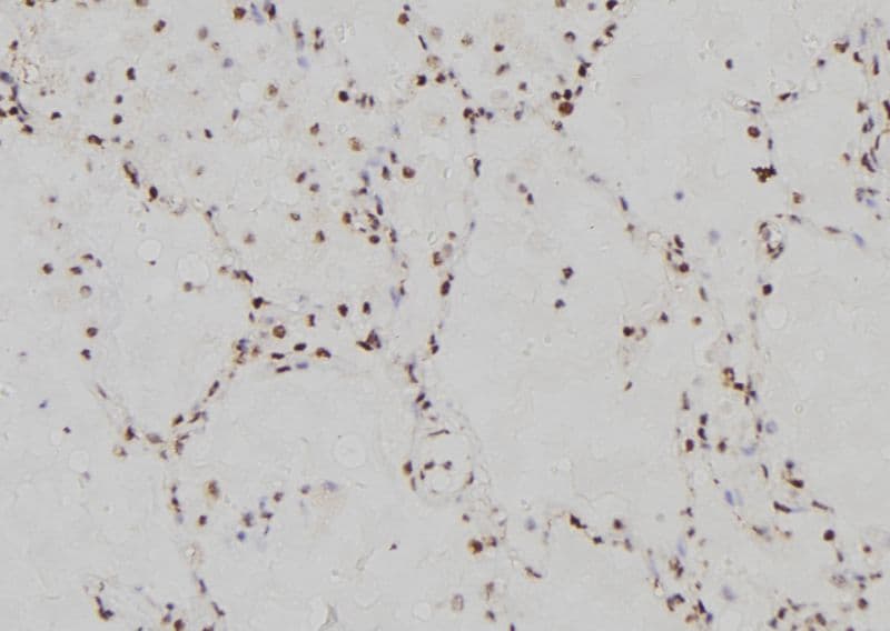 Polyclonal Rabbit anti-Human IRF3 Antibody (IHC, IF, WB)