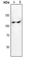 Polyclonal Rabbit anti-Human FAK / Focal Adhesion Kinase Antibody (WB)