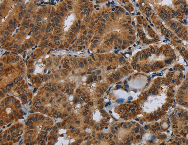 Polyclonal Rabbit anti-Human Glucocorticoid Receptor Beta Antibody (IHC)