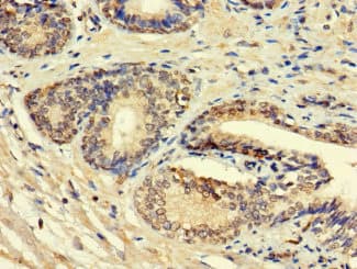 Polyclonal Rabbit anti-Human HSD11B1L Antibody
