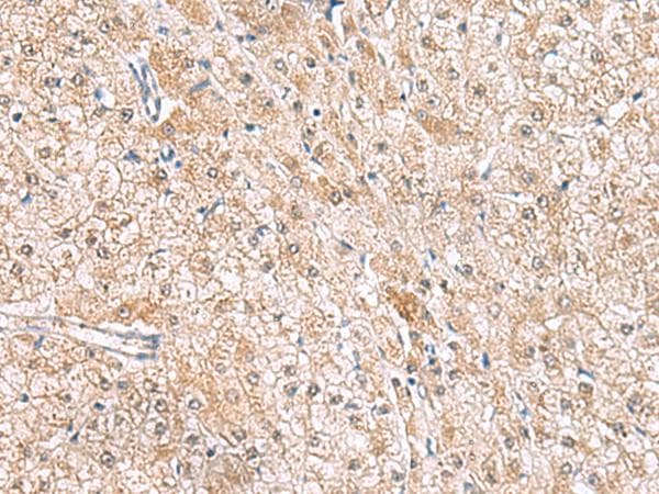 Polyclonal Rabbit anti-Human HLA-E Antibody (IHC)