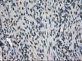 Monoclonal Mouse anti-Human MKI67 / Ki67 Antibody (clone OTI3D11, IHC, WB)