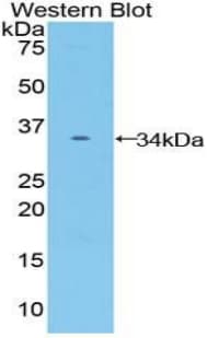 FZD10 / Frizzled 10 Antibody (aa235-495, FITC)