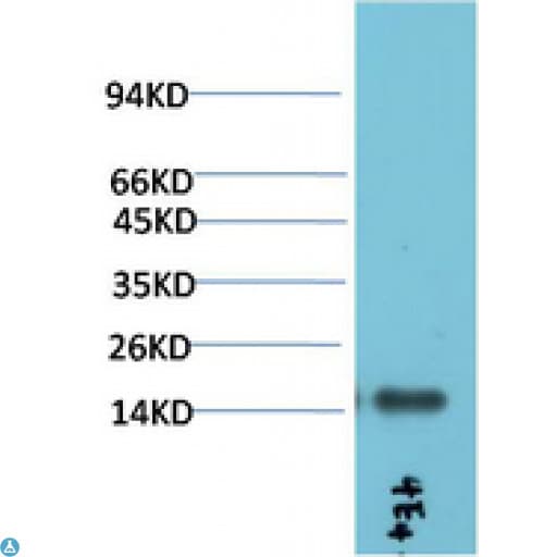 TTR / Transthyretin Antibody