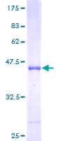 Human C1D Protein (Recombinant GST)