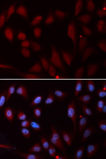 Polyclonal Rabbit anti-Human NPC2 Antibody (IHC, IF, WB)